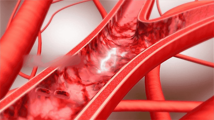 Animated visualization of healthy blood circulation